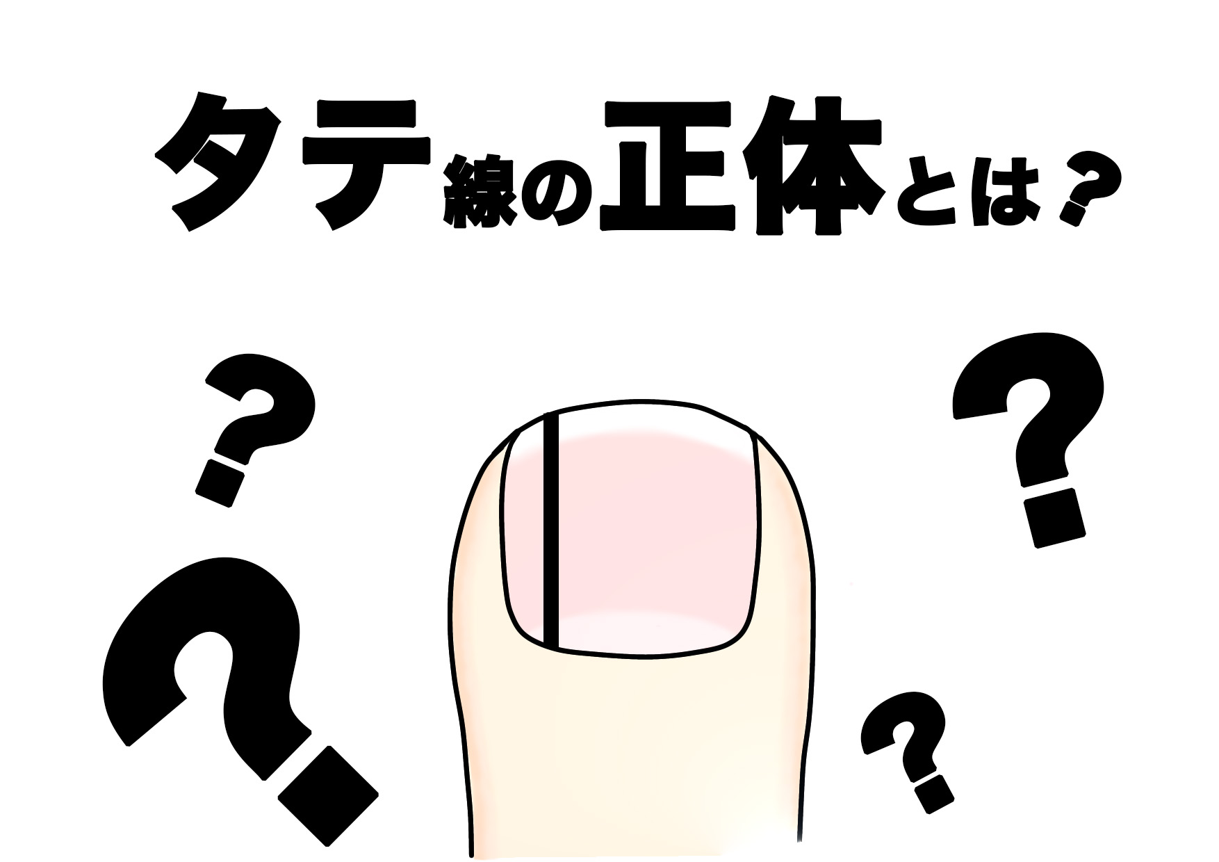 爪 縦 線 黒