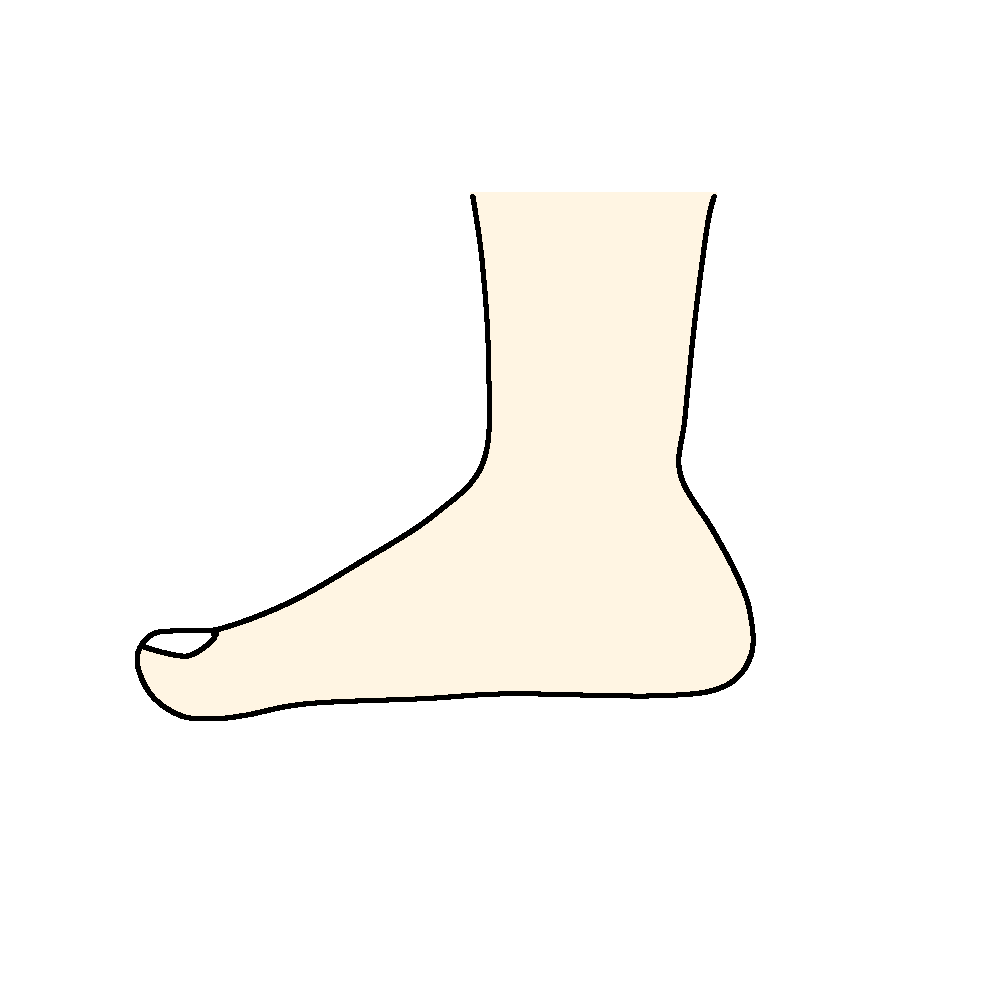 扁平足イラスト