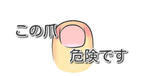 深爪コラム用アイキャッチ