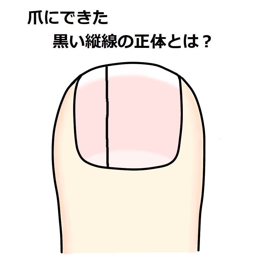 爪 縦 線