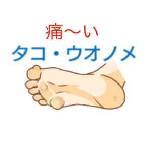 越谷の巻き爪専門院 痛いたこや魚の目