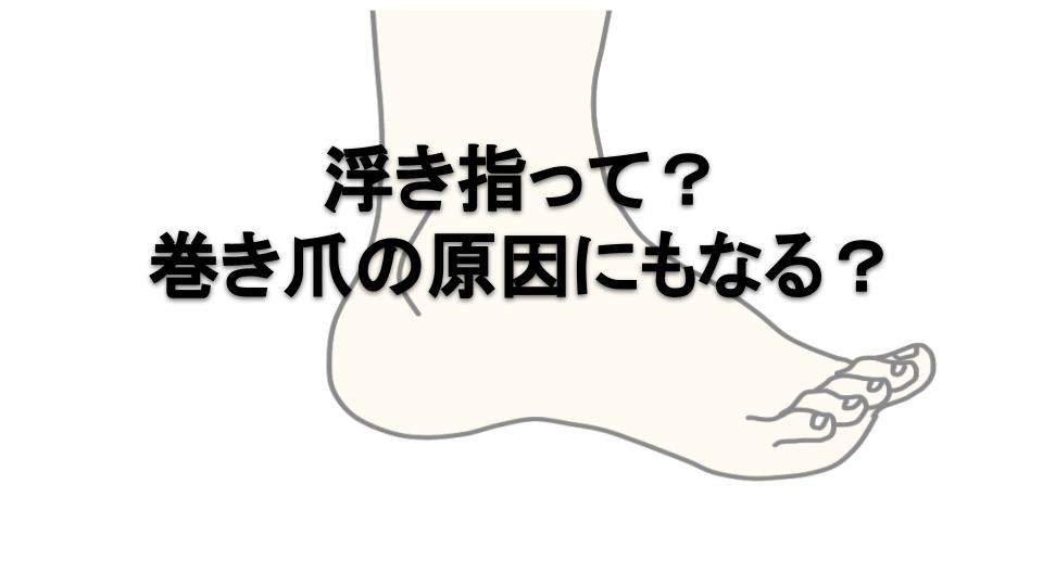 東京巻き爪矯正院国立院浮指のイラスト