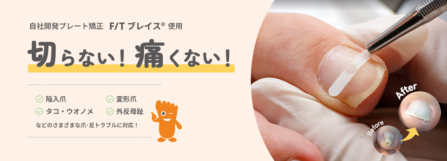 切らない！痛くない！巻き爪矯正院トップビジュアル