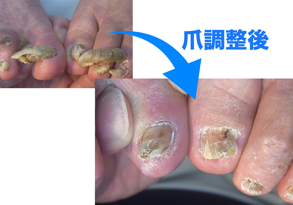 爪切り調整①