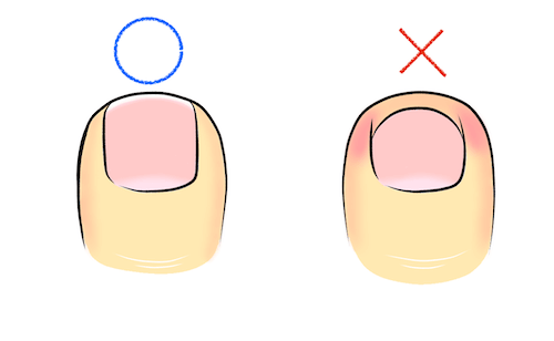 良い爪の切り方と悪い切り方