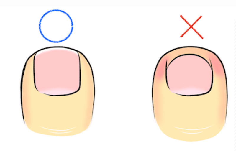 爪の正しい切り方と悪い切り方