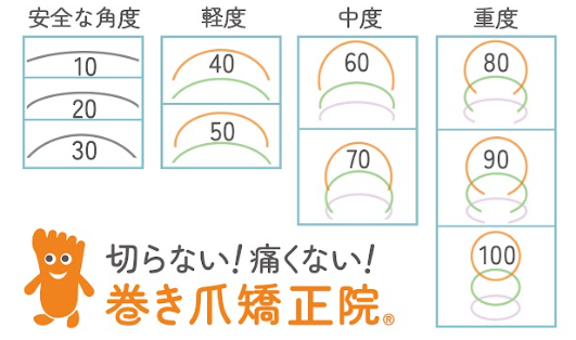 東京巻き爪矯正院 新宿院　巻き爪度数