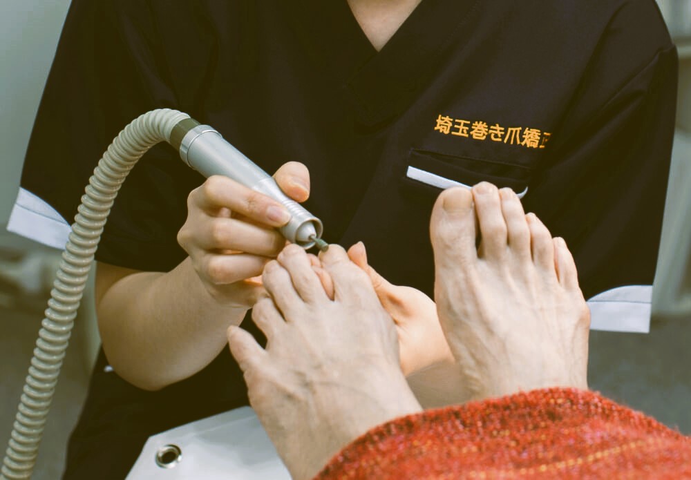 施術工程イメージ