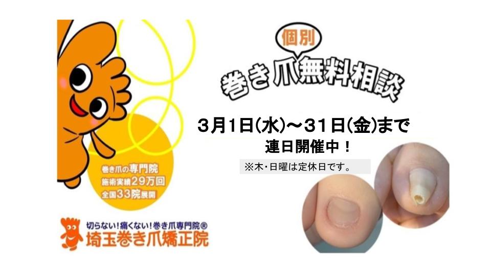 埼玉巻き爪矯正院 所沢院の巻き爪無料相談会告知画像